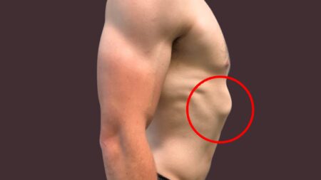 Understanding the causes of flared ribs and how to prevent them