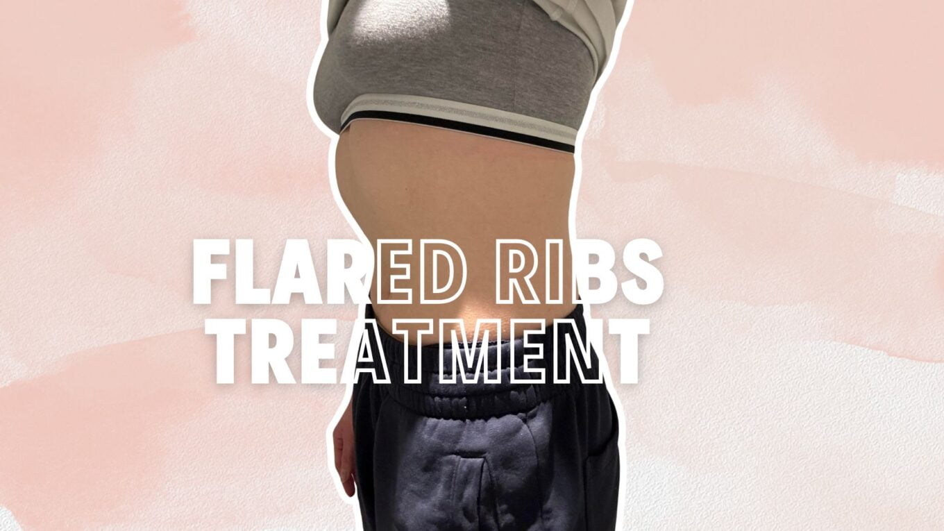 Top Acupuncture and Chiropractic Treatments for Flared Ribs Relief